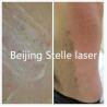 Buy cheap Professional IPL SHR Hair Removal Machine Multi Functional Skin Care Beauty Instrument from wholesalers