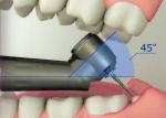 Dental LED 45 Degree Fiber Optic Portable High Speed Handpiece