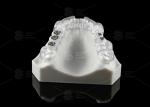 Custom Made Transparent Dental Implant Solution Surgical Stent Ergonomic Design