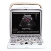 Buy cheap Portable 3.5MHz 7.5MHz 6.0 MHz Ultrasound Scanner Machine For Gynecology product