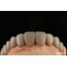 Buy cheap PFM Porcelain Fused to Metal Crowns and Bridges Seamless Bonding for Natural Smiles from wholesalers