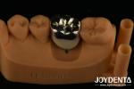 Oral Rehabilitation Wax Casting FMC Full Metal Crown For Dental Clinical Repair