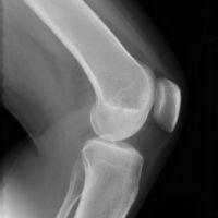 Buy cheap High Sharpness Xray Films from wholesalers