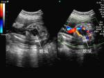 Transportaple 3D / 4D Color Doppler Ultrasound System , 3.5MHz R80 Volume Probe