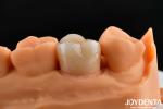 Dental Multilayer Full Zirconia Crowns And Bridges High Translucent Natural