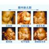 Buy cheap Medical 3D / 4D Color Doppler Ultrasound System Portable With 15 inch LED Monitor from wholesalers