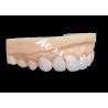 Buy cheap Porcelain EMAX Veneer High Precision Esthetic Restorations with Superior Durability from wholesalers