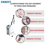 Q-switch ND YAG laser tattoo removal / nd yag laser pigment treating