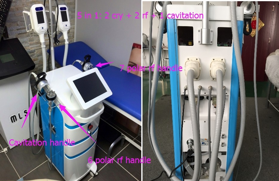 Cryo handles cool tech fat freezing weight loss vacuum machine