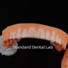 Buy cheap High Esthetics Dental Snap On Smile Standard Dental Lab from wholesalers