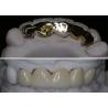 Buy cheap High Durability Biocompatible Porcelain Fused To Metal Crown Precise Fit Custom from wholesalers