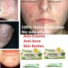 Buy cheap natural anti-bacteria gel anti acne anti eczema herbal gel from wholesalers