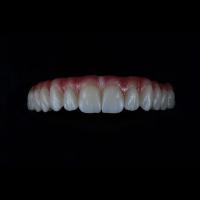 Buy cheap Full Coutour Arch Zirconia Fixed Dentures Crown Biocompatible Material product
