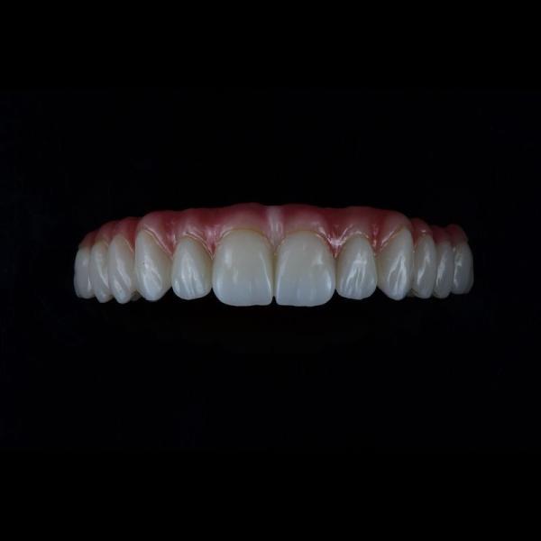 Buy cheap Full Coutour Arch Zirconia Fixed Dentures Crown Biocompatible Material from wholesalers