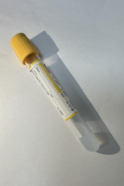 Buy cheap Infectious Disease Screening Smart Separation Technology Rapid Clotting Acceleration from wholesalers