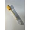 Buy cheap Infectious Disease Screening Smart Separation Technology Rapid Clotting Acceleration from wholesalers