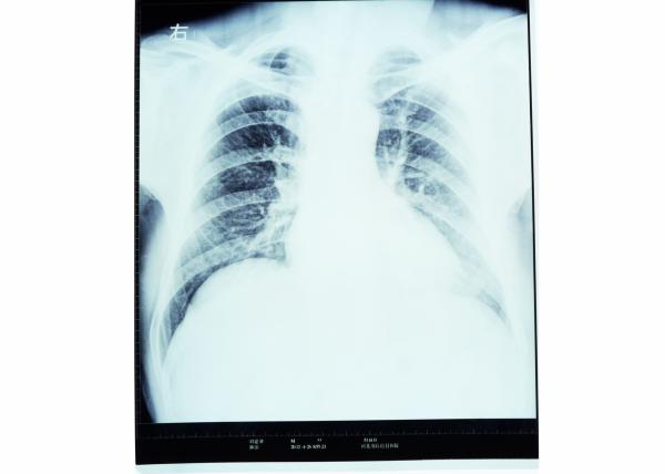 Buy cheap Dry X Ray Medical Diagnostic Imaging Radiology For AGFA / FUJI 2000 from wholesalers