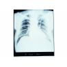 Buy cheap 10 x 14 X-ray Medical Dry Imaging Film Sensitive Thermal For Fuji Printer from wholesalers