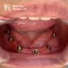 Buy cheap Nature Design Dental Implant Case Implant Operation Cases For Multiple Choices from wholesalers