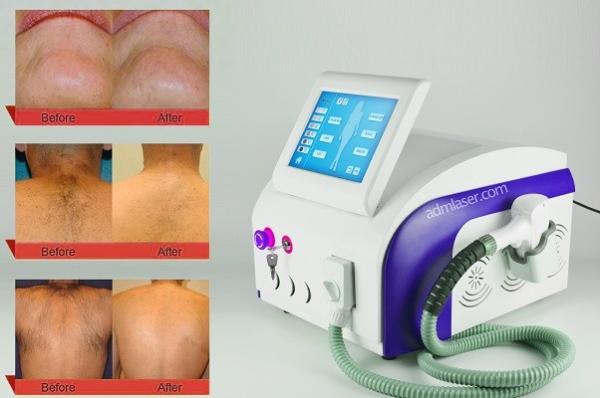 Buy cheap 12*20mm 808nm 755nm 1064nm Laser Hair Removal Equipment from wholesalers