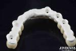 High Strength Ti-Base Hybrid Zirconia Bridge Fracture Resistance Dental Solution