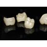 Buy cheap Natural Full Contour Zirconia Crown Precise Fit Full Contour Dental Lab from wholesalers