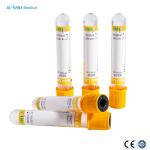 Gel Clot Additive SSGT Plastic Vacuum Blood Sample Collection Tube Disposable