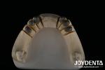 Steel Locator Dental Attachments , Precision Partial Denture Attachments