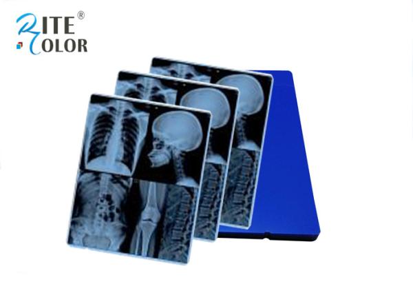 Buy cheap Blue Laser X Ray Film Digital X Ray Film For CT MR Equipment Image Output from wholesalers