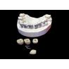 Buy cheap Polished Surface Dental Implant Screw Retained Crown For Tooth Replacement from wholesalers