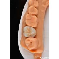 Buy cheap Dental Multilayer Full Zirconia Crowns And Bridges High Translucent Natural product