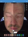 Buy cheap Facial 3d Skin Analyzer Scanner Visia 32gb Storage For Doctor Skin Clinic from wholesalers