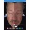 Buy cheap Professional Facial Skin Analysis Machine With Sharing Could Storage from wholesalers