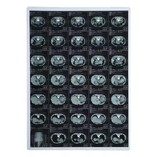 Buy cheap Inkjet Printing Dry Laser X Ray Imaging Film For Hospital Medial Devices from wholesalers