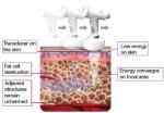 salon beauty equipment hifu Korea for fat removal system