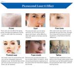 Portable Picosecond Laser Machine High Efficiency For Tattoo Removal