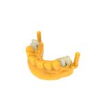 Permanent Crown Bridge Resin with 2 Years Shelf Life and High Shore D 92