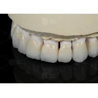 Buy cheap Natural Tooth Color Ceramic Feldspathic Veneer For Anterior And Posterior Teeth product