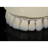 Buy cheap Natural Tooth Color Ceramic Feldspathic Veneer For Anterior And Posterior Teeth from wholesalers