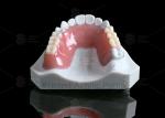 Orange Pink Acrylic Partial Denture Natural Looking 3d Printing Digital Dentures