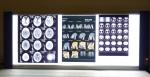 Bright Medical X Ray Dry Thermal Printer Film Laser Blue Base