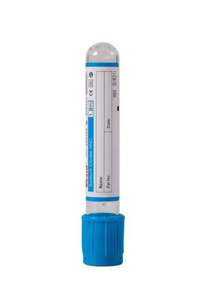 Buy cheap Anticoagulant Bd Sodium Citrate Tubes 6ml 7ml Sodium Citrate Vacutainer Tubes from wholesalers
