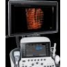 Buy cheap Samsung Medison WS80A Ultrasound LCD Monitor MI96-01425A from wholesalers