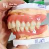 Buy cheap Full Arch Removable Acrylic Denture Customizable Natural Looking Denture from wholesalers