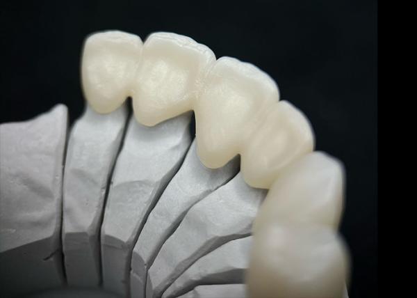 Buy cheap Dental Solid Zirconia Crown Ombining Outstanding Strength And Natural Aesthetics from wholesalers