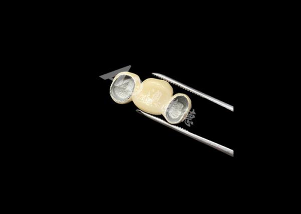 Buy cheap Precise Fit Porcelain Fused To Metal Crown With Excellent Biocompatibility from wholesalers