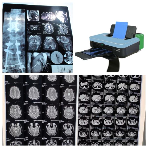 Buy cheap 10inch Inkjet Color X Ray Film For Medical Imaging 210 Microns from wholesalers