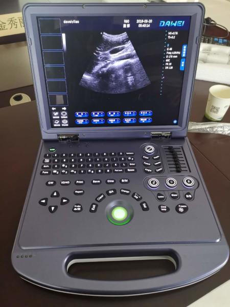 Buy cheap CE Portable Ultrasonic Diagnostic System 4d Color Doppler Ultrasound 300mm from wholesalers