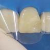 Buy cheap Anterior Matrix Strips Dental Roll Dental Resin Strip Roll from wholesalers