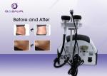 Portable RF Vacuum Weight Loss Machine 400KPa Pressure 38*60*70cm Size